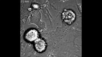 PLoS ONE : Role of Cortactin Homolog HS1 in Transendothelial Migration of Natural Killer Cells