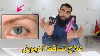 وصفة طبيعية لعلاج تساقط الرموش