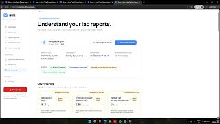 Nura: features explaination and demo screenshot 1