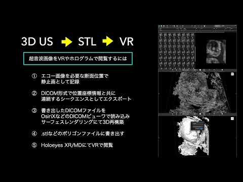 【エコー画像でVR】超音波画像をOsiriX でDICOMシークエンスで書き出しポリゴン作成しVRへ