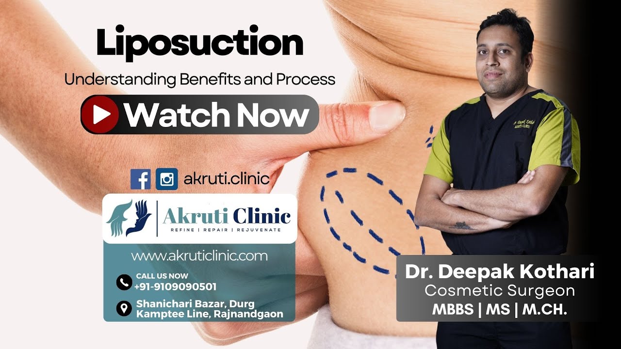 Safety Measures Benefits Of Liposuction Surgery For Weight Loss Dr safety-measures-benefits-of-liposuction-surgery-for-weight-loss-dr