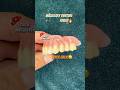 Perfect Maxillary Denture#dental#dentist#cesar#satisfying#handmade#parati#fyp#shorts#viral#reels#yt