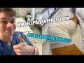 MIKAEL KÄIS OPERATSIOONIL!? / KEERDTREPP INFOMINUTID