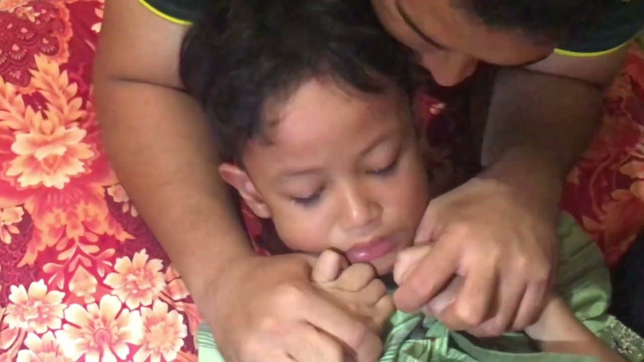 Ahsan sunat moderen bersama kelinik hamzah