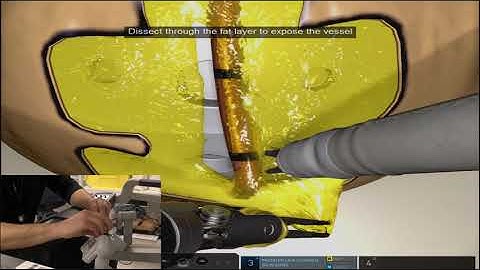 Da Vinci Skills Simulator. Robotic Sim Tips and Tricks: Vessel Energy Dissection