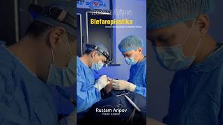 #блефаропластика #сангапури #ковоколиш #докторарипов #пластическийхирург