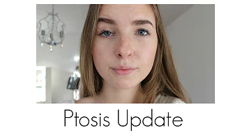 Was kann man gegen Ptosis machen?