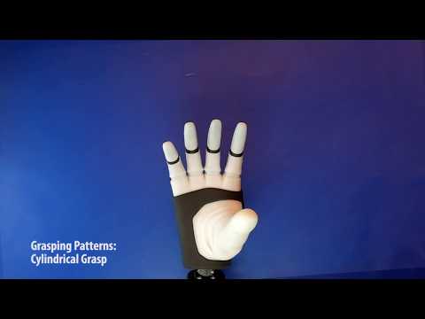 DeTOP project - Sensorized Hand Prosthesis