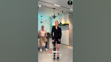 She Lost a Leg, But Not Her Spark ✨ Walking with Confidence & Grace! #walkingsupport