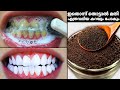       1  teeth whitening at home