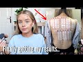 FINALLY FINDING OUT WHAT CAUSED MY SKIN ISSUES.. Weekly vlog | sophdoesvlogs