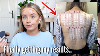 FINALLY FINDING OUT WHAT CAUSED MY SKIN ISSUES.. Weekly vlog | sophdoesvlogs