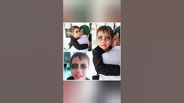 هذا الطفل مدمن اللعب على الهاتف لذلك قامت والدته برسم ظل على كلتا عينيه عندما كان نائم 