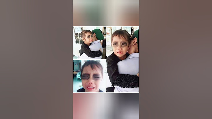 هذا الطفل مدمن اللعب على الهاتف لذلك قامت والدته برسم ظل على كلتا عينيه عندما كان نائم