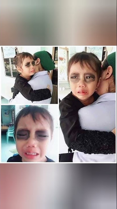 هذا الطفل مدمن اللعب على الهاتف لذلك قامت والدته برسم ظل على كلتا عينيه عندما كان نائم