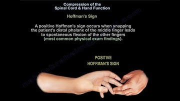Can Compression of the Spinal Cord and Cervical Myelopathy Affect Hand Function?