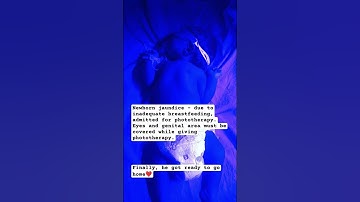 Newborn jaundice / effects of phototherapy / NICU diaries #drmonickacares