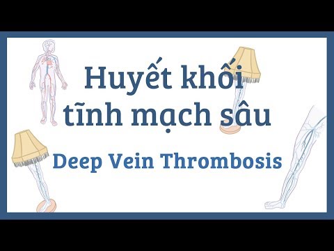 Huyết khối tĩnh mạch sâu -  nguyên nhân, triệu chứng, chẩn đoán, điều trị, bệnh lý