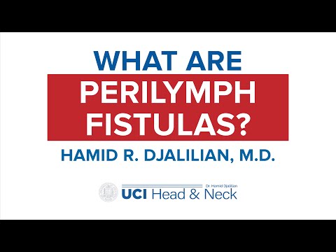 Video: Da li perilimfna fistula zacjeljuje sama?