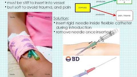 TRIZ - Separation Principles and Innovation Workbench