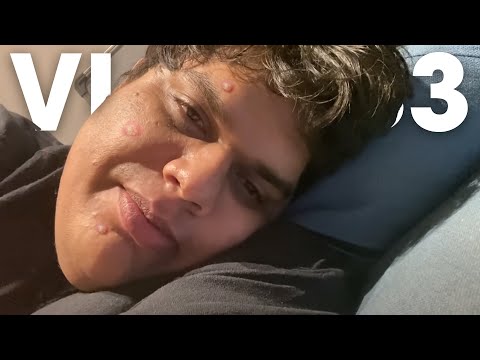 LOOK WHAT HAPPENED TO MY FACE - VLOG 33