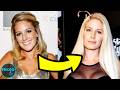 10 Celebrity Plastic Surgery Nightmares