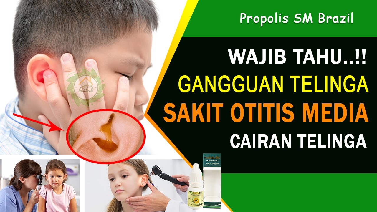 Cara Mengatasi Otitis Media (Congek) dan Penyebabnya 