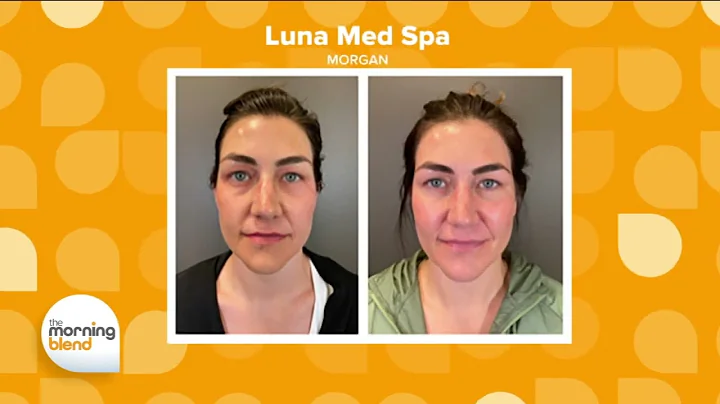 Luna Med Spa on the Morning Blend