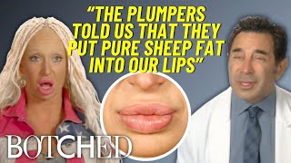 Unbelievable Lip Filler Fail Ashley Had Sheep Fat Injected In Her Lips? Botched E