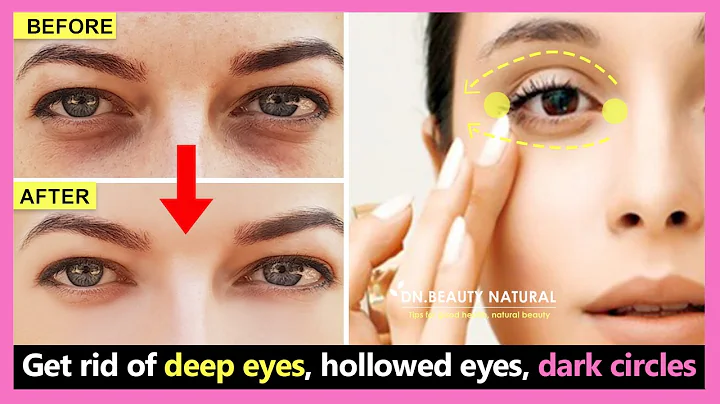 How to get rid of deep eyes, hollowed eyes, dark circles and wrinkles under the eyes | Eye exercises - DayDayNews