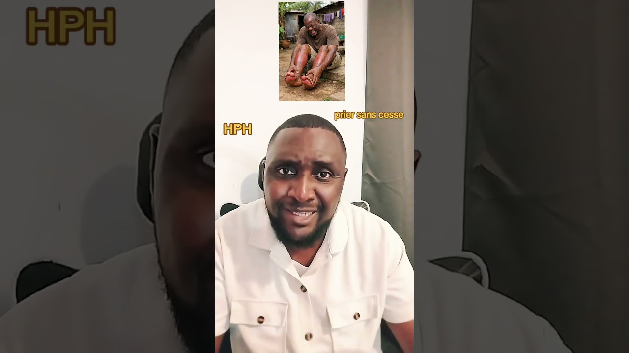 Il ramasse 10000 FCFA d'une revenante,refuse de remettre et se retrouve avec des pieds gonflés 