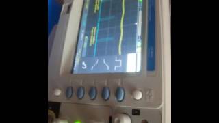PPM MODULATION/ DEMODULATION TRAINER (BCT-08)  KITEK