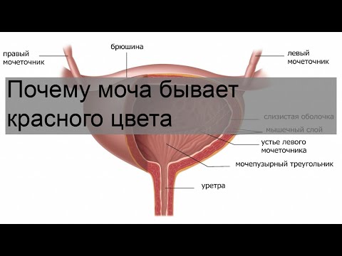 Почему моча бывает красного цвета