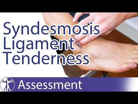 Syndesmosis Ligament Tenderness Palpation | Syndesmosis Injury