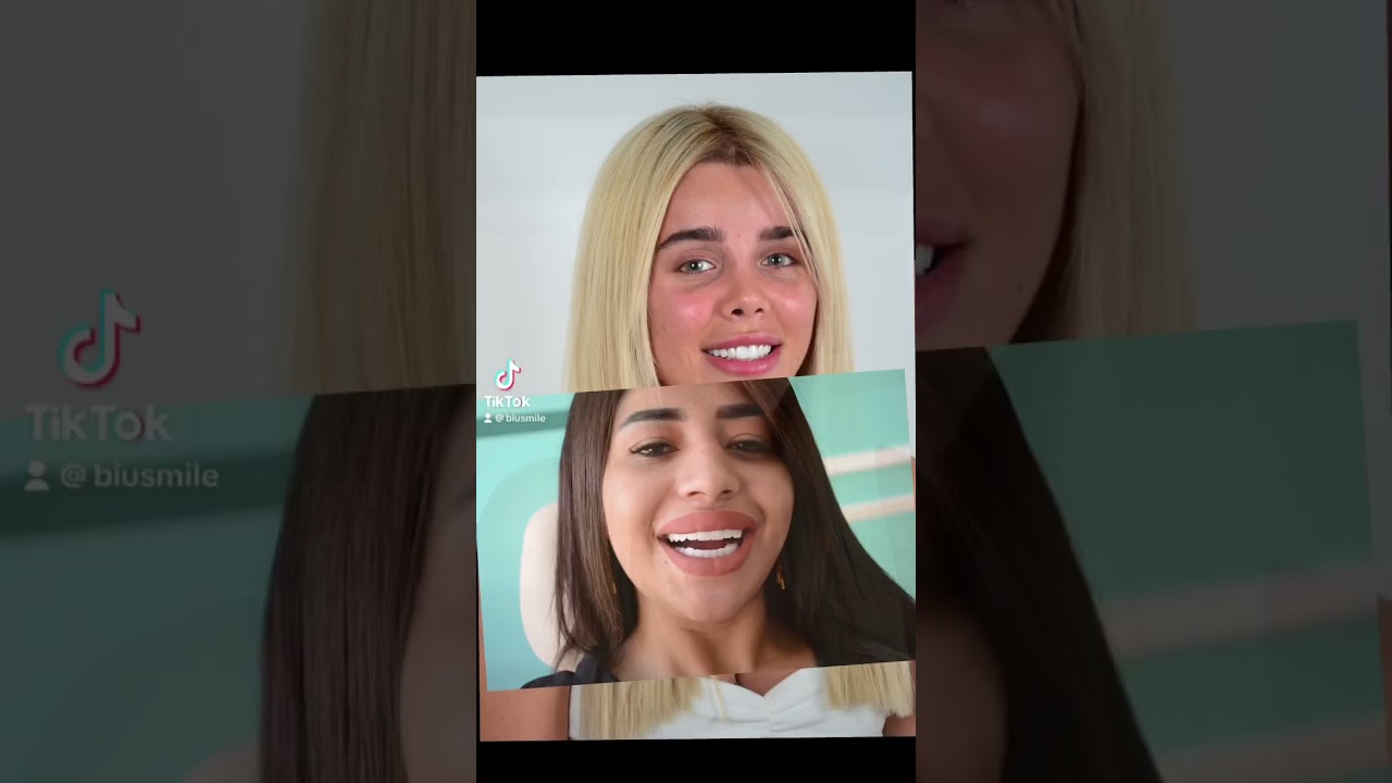 Biu smile number one in istanbul 