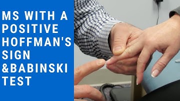 MS with positive Hoffman