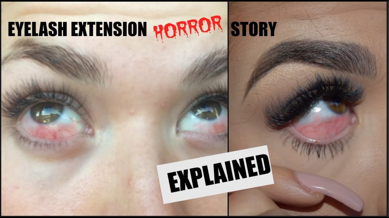 Eyelash Extension Horror Story... Explained
