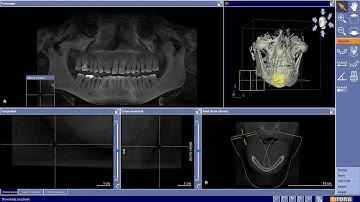 CBCT Axial Image Plane