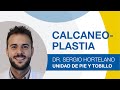 Tratamiento para la deformidad de Haglund: Calcaneoplastia