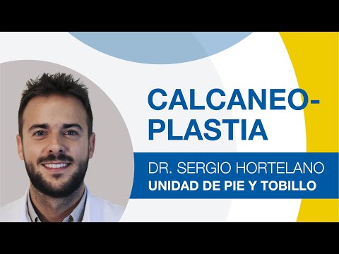 Tratamiento para la deformidad de Haglund: Calcaneoplastia