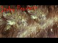 Itchy Psoriasis | Removing dandruff Flake on Poor Girl's head with lice comb # 252
