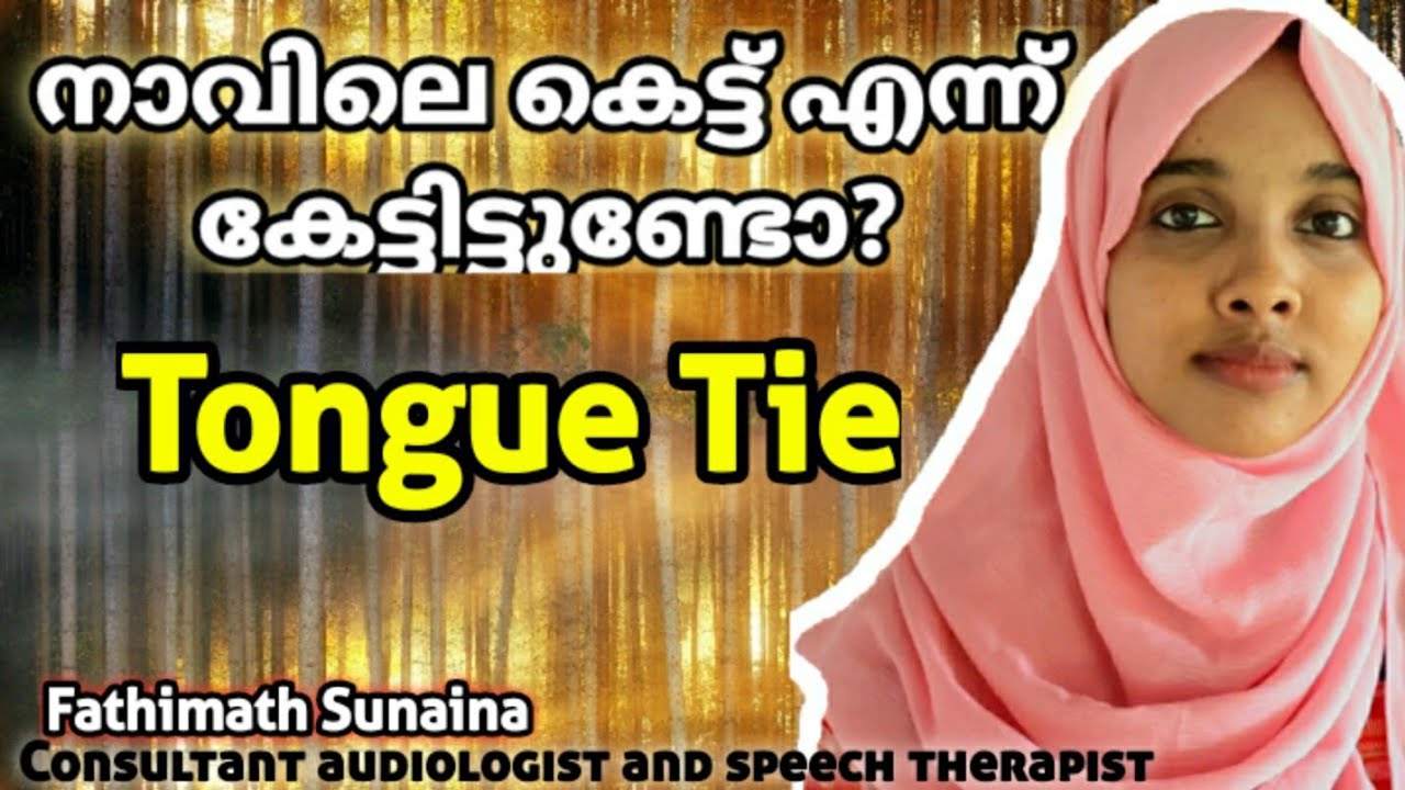 TONGUE TIE | നാവില് കെട്ട് എന്ന് കേട്ടിട്ടുണ്ടോ ?