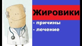 Жировики: причины появления, как от них избавиться