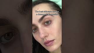 Have a damaged skin barrier? Try these two products #shorts #skinbarrier #acnetreatment Have a damaged skin barrier? Try these two products #shorts #skinbarrier #acnetreatment