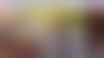 Intumescent cataract (Extremely shallow anterior chamber) Dr. Deepak Megur