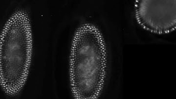 OpenSPIM: an open-access light-sheet microscopy platform 3
