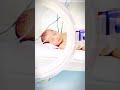#viralvideo #cutebaby #baby #cute #icucare #love #duet #mrbeast #babygirl #voiceeffects