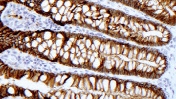 DakoLink  IHC Autostainer MAR14 720p 12587 1