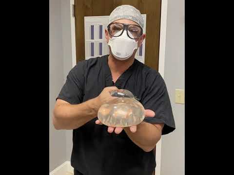 High Profile Implant VS Gummy Bear Implant - YouTube