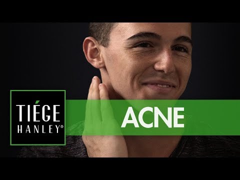 Tiege Hanley ACNE | Daily Moisturizing Acne Cream | Tiege.com